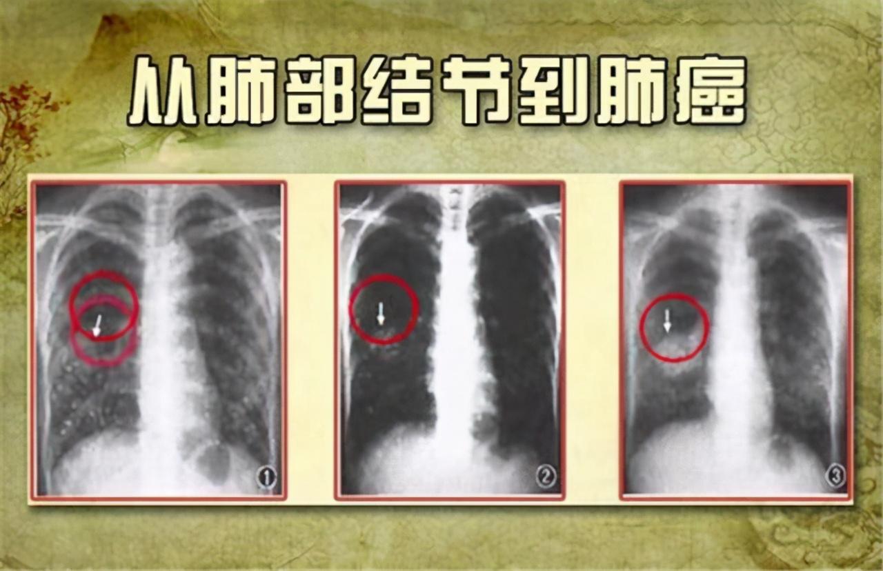 新澳门最准的四肖期期准，详细解答、构建解答解释落实
